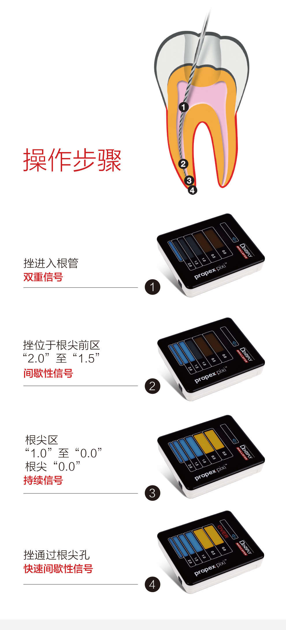 登士柏/dentsply 根管测量仪(根尖定位仪)根测仪propex pixi