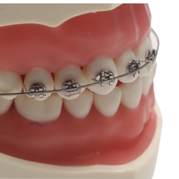 登士柏/dentsply 正畸弹性体附件s型透明结扎圈